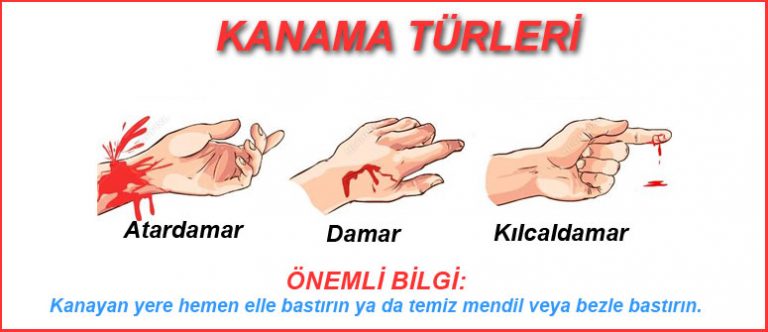 Kanama türleri