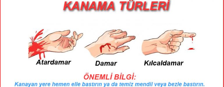 Kanama türleri