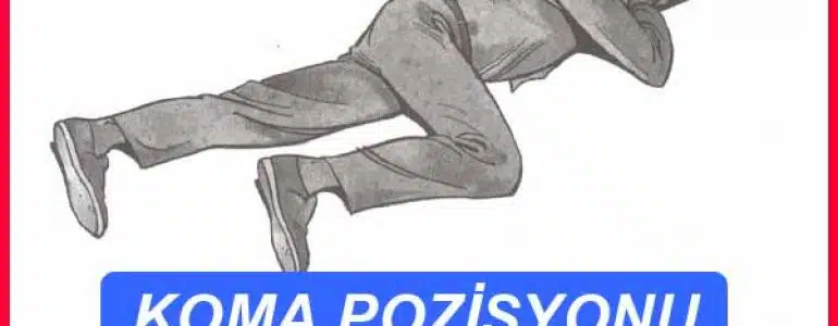 Koma pozisyonu