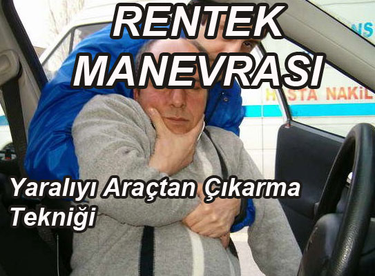 Rentek manevrası
