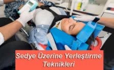 Sedye üzerine yerleştirme teknikleri