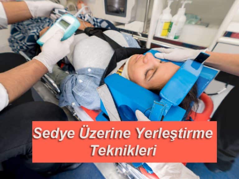Sedye üzerine yerleştirme teknikleri
