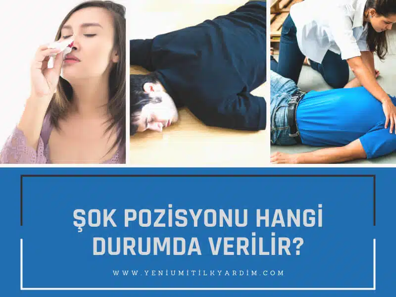 Şok Pozisyonu Hangi Durumda Verilir?