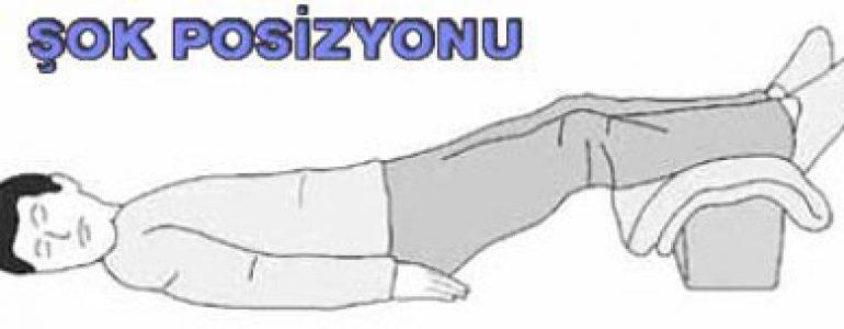 Şok pozisyonu nasıl verilir.