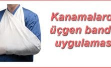 Üçgen Bandaj Uygulaması