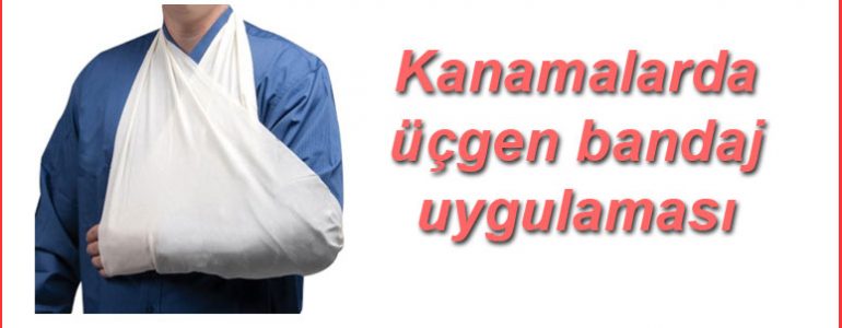 Üçgen sargı bezi