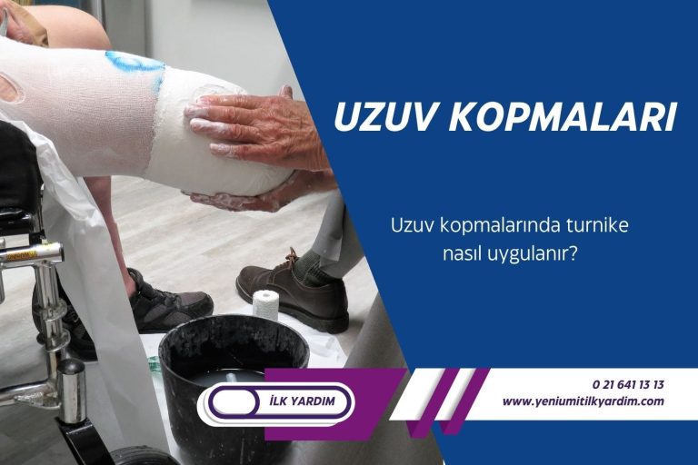 Uzuv kopması