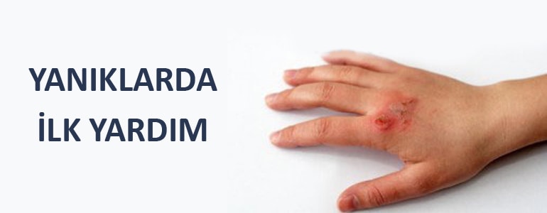 yanıklarda ilkyardim2 min