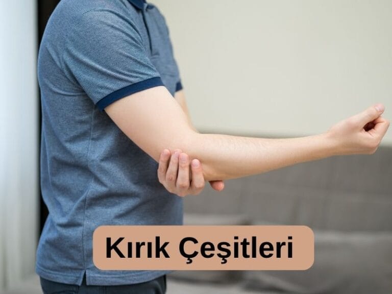 Kırık Çeşitleri