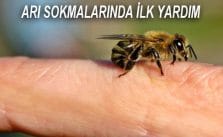 Arı Sokması Belirtileri ve İlk Yardım