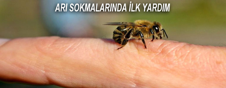 arı sokmalarında ilk yardım