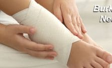 Burkulma nedir?