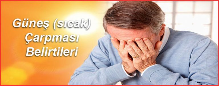 Güneş çarpması