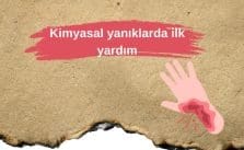 Kimyasal Yanıklarda İlk Yardım
