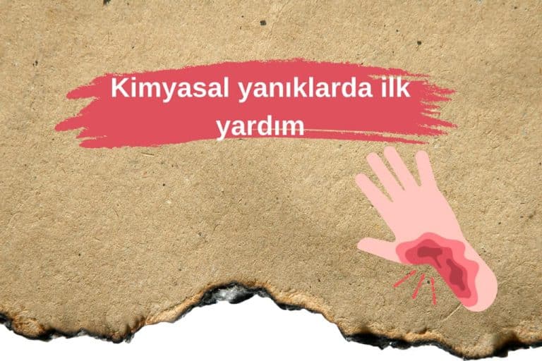 Kimyasal yanıklarda ilk yardım