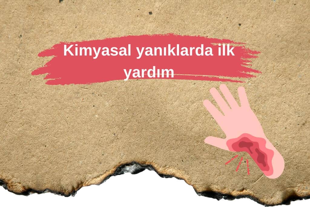 Kimyasal yanıklarda ilk yardım
