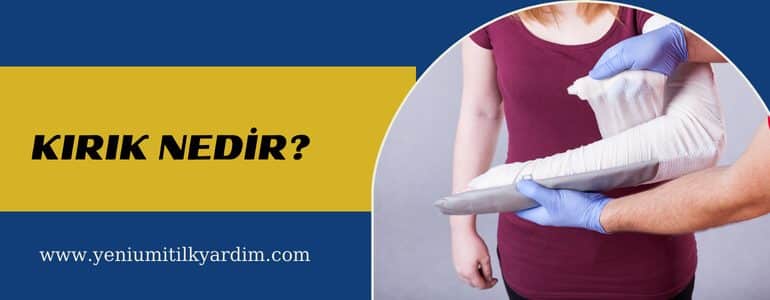 Kırık nedir?