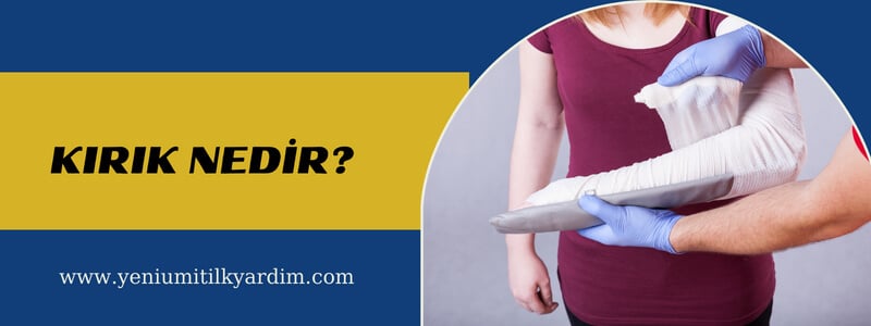 Kırık nedir?
