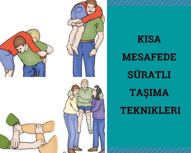 Kısa mesafede Taşıma Tekniği