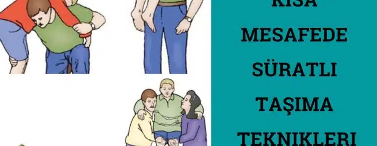 Kısa mesafede Taşıma Tekniği