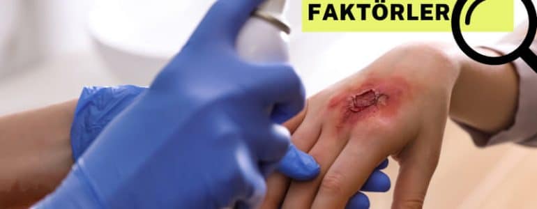 Yanığın ciddiyetini belirleyen faktörler