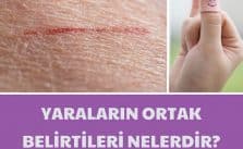 Yaraların ortak belirtileri nelerdir?