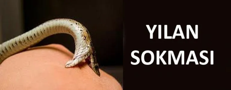 yılan sokması