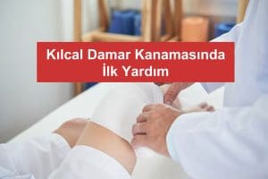 Kılcal Damar Kanaması