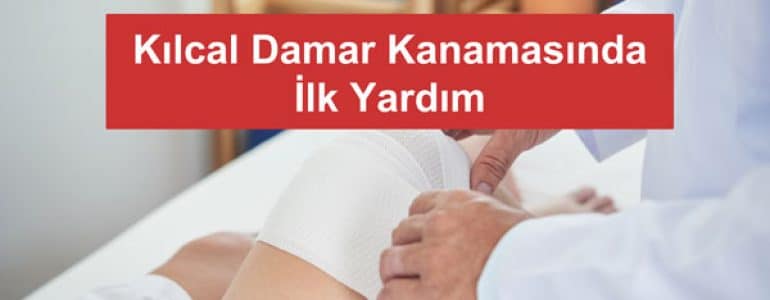 Kılcal Damar Kanaması
